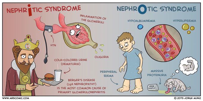 Nephrotic vs nephretic