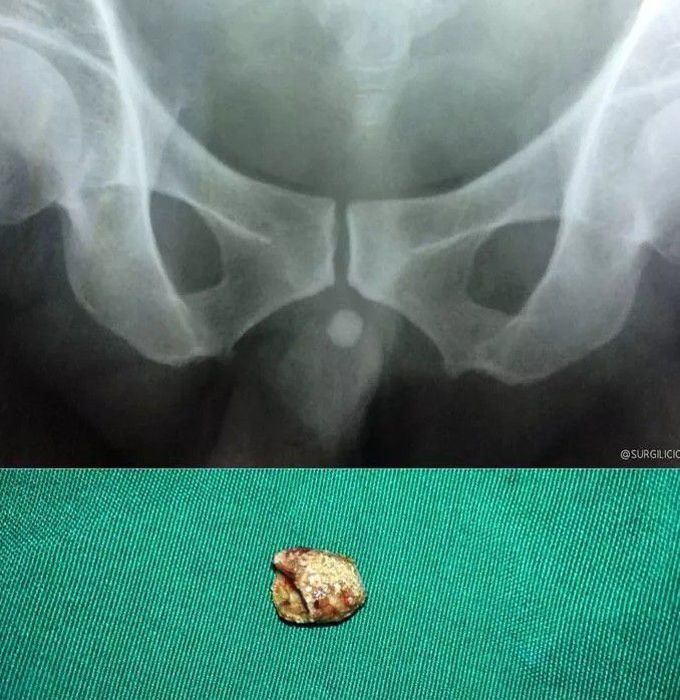 trauma surgery