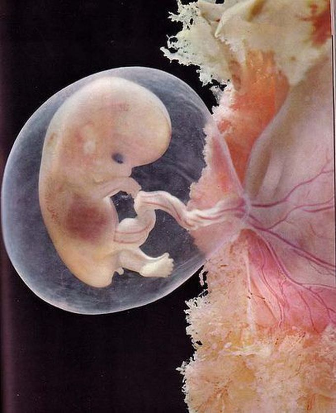 Human embryo
