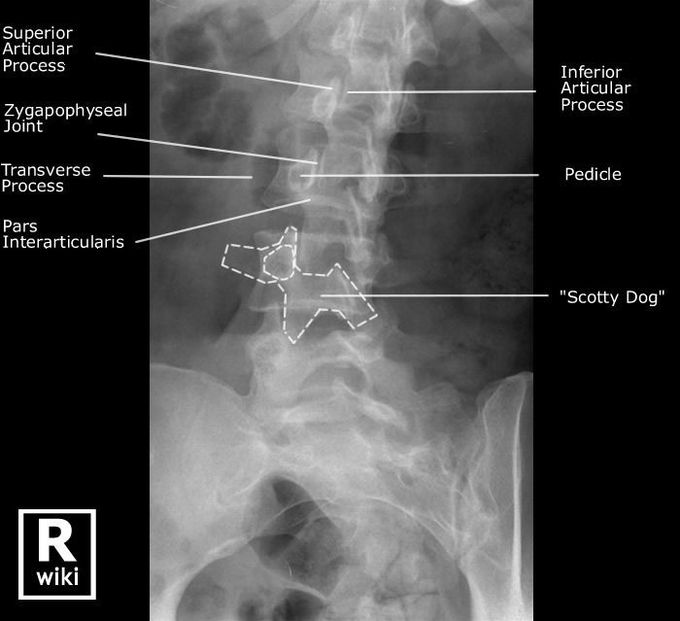 Lumbar Spine Radiographic Anatomy
