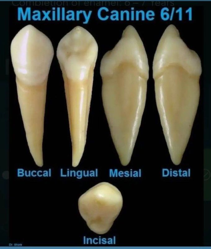 Maxillary Canine