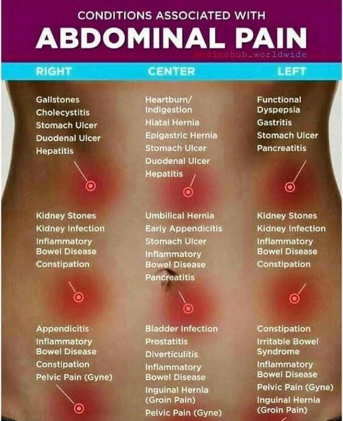 Conditions associated with abdominal pain