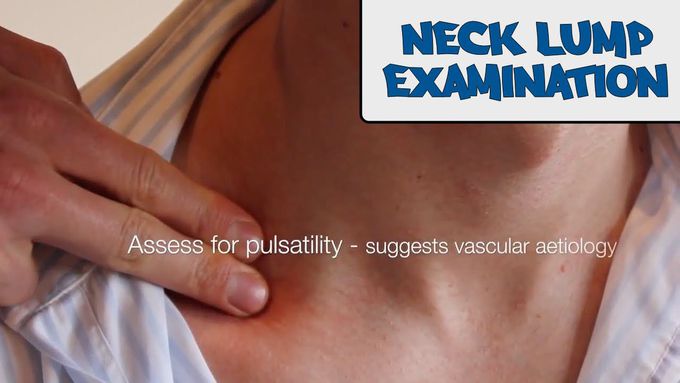 Examination of a Neck Lump