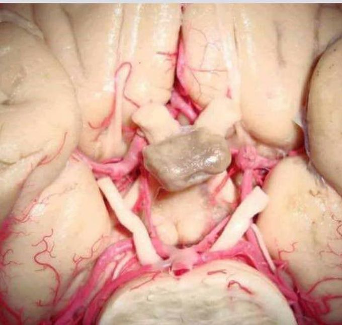 pituitary gland