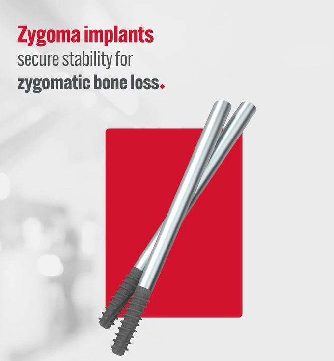 Zygoma Implants