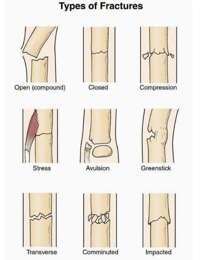 Orthopedic
