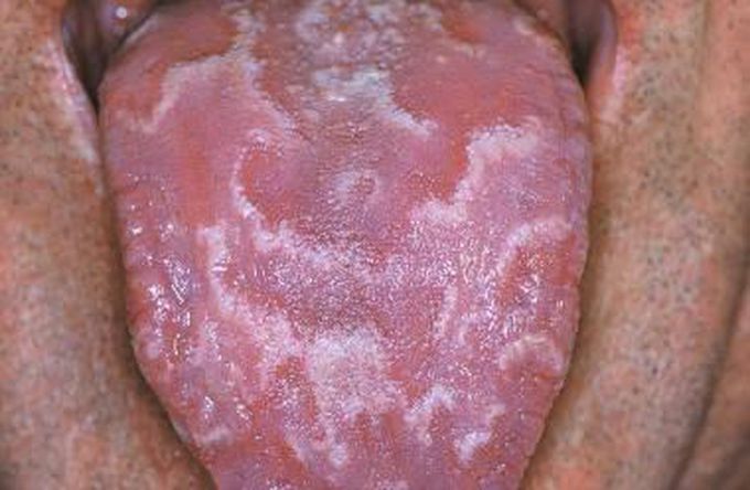 What is Diagnosis this condition patient?