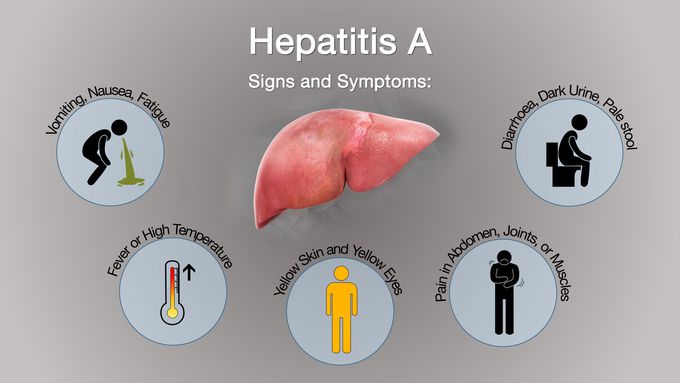 Symptoms of Hepatitis A