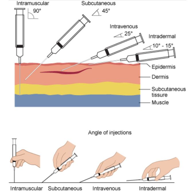 Injection angle