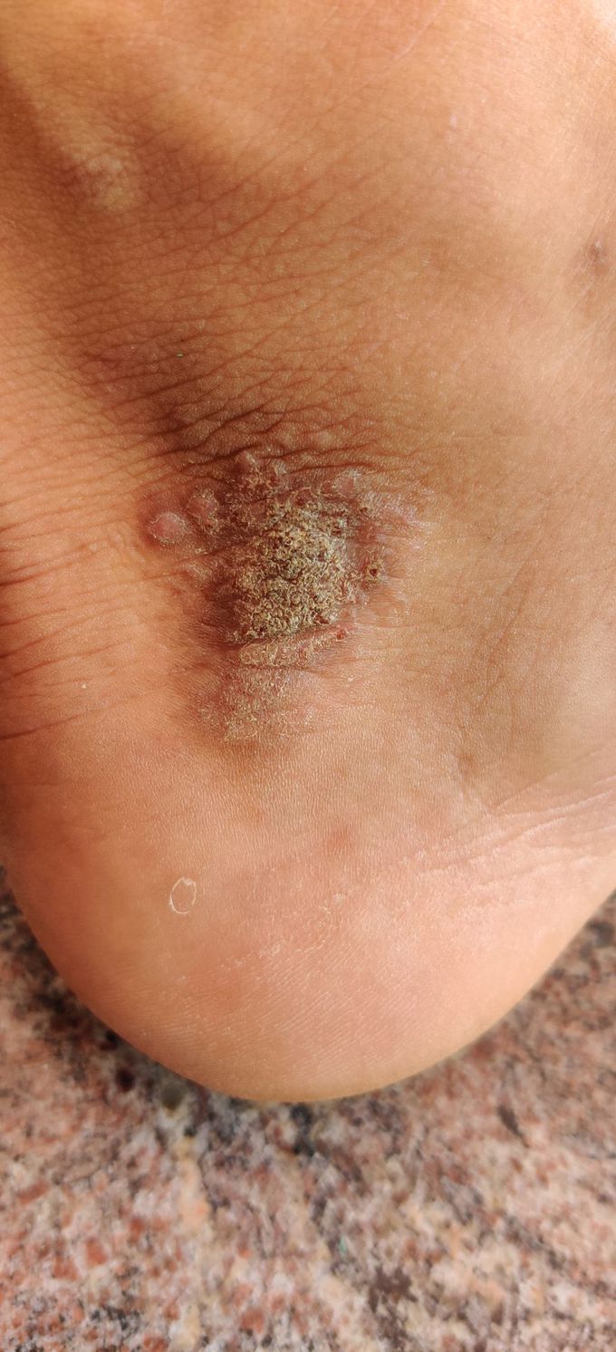 Diagnosis?? Treatment???