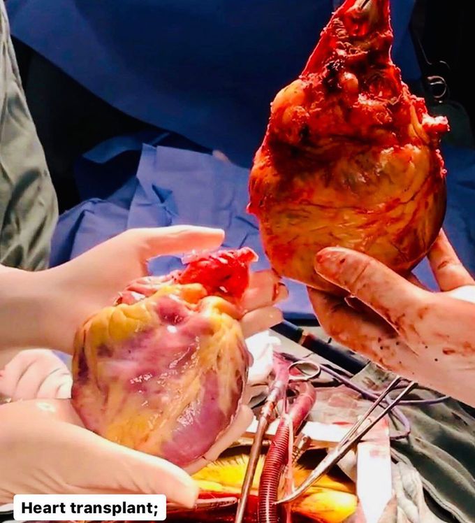 Heart transplant in progress! 💕 