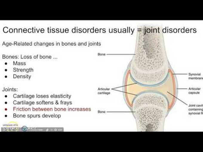 Connective Tissue Disorders - part 1