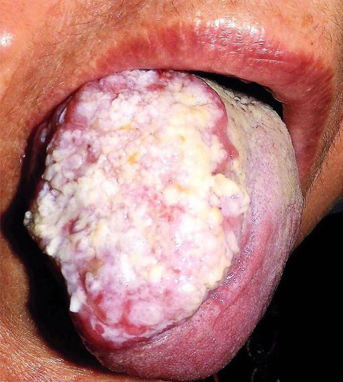 What is your diagnosis??