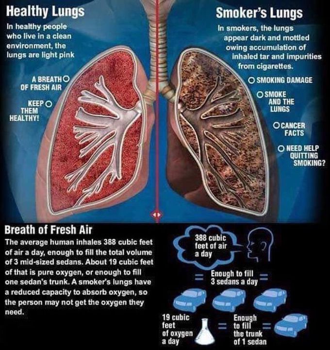 Healthy Lungs vs Smokers Lunges