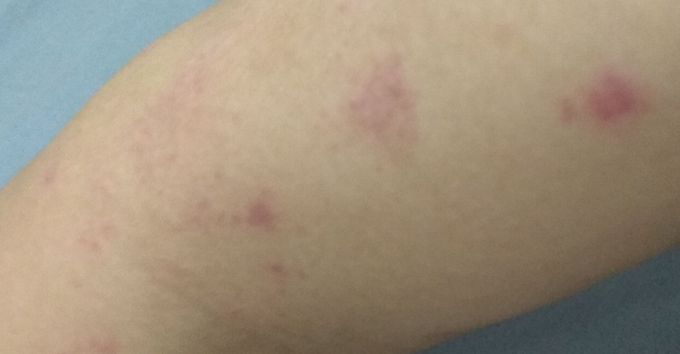 Diagnosis?