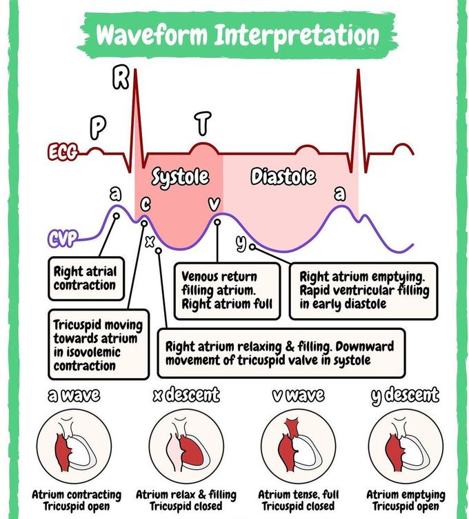 Waveform Interpretation