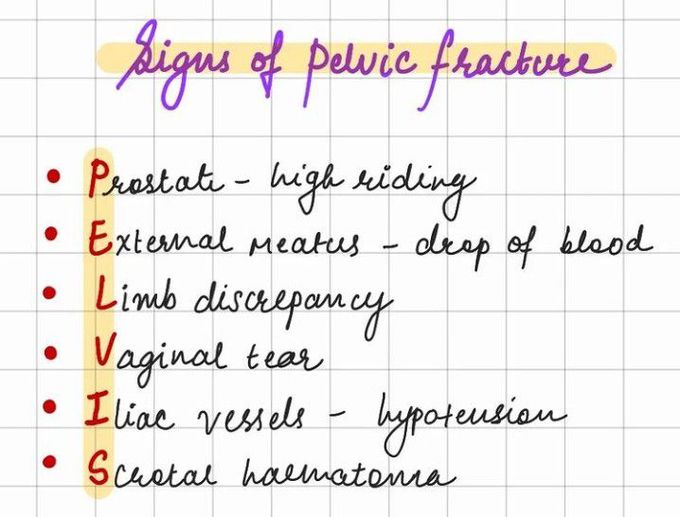 Signs Of Pelvic Fracture - MEDizzy