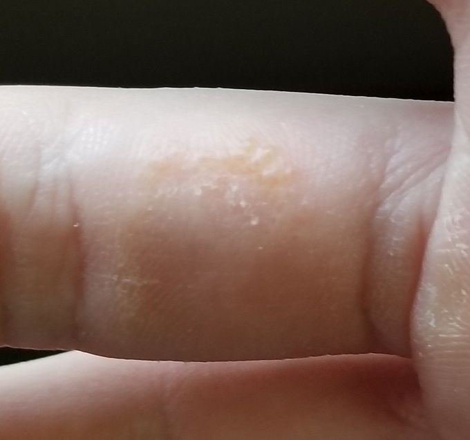 Diagnosis?