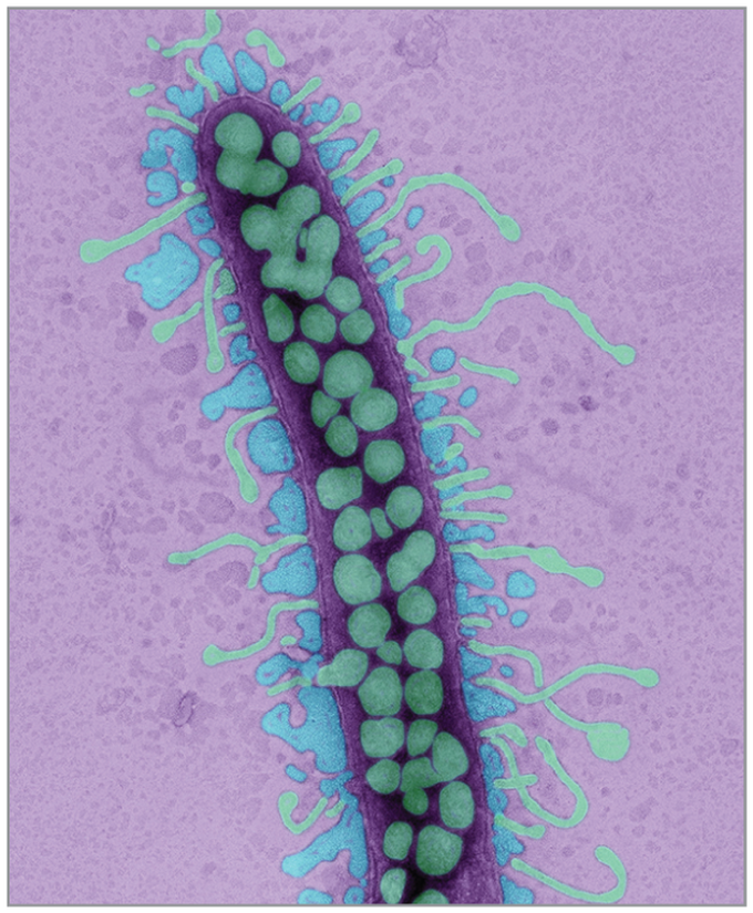 FDA Approves the First Bacteriophage Therapy Trial, the Same Treatment used for a Professor at UCSD in 2017.
