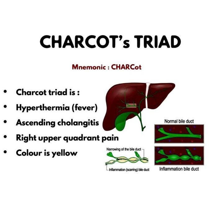Charcot Triad
