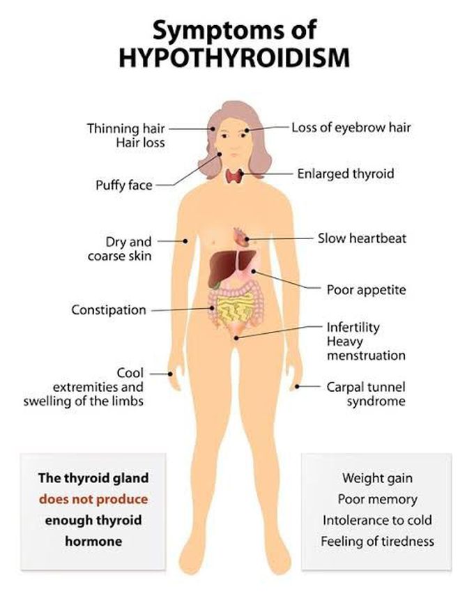 Symptoms of hyperthyroidism