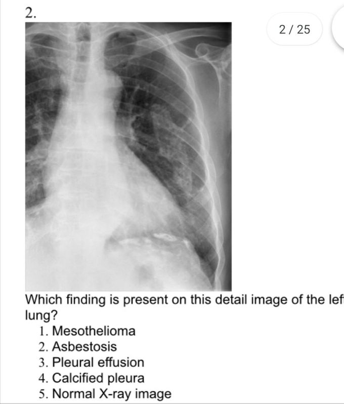 X-ray