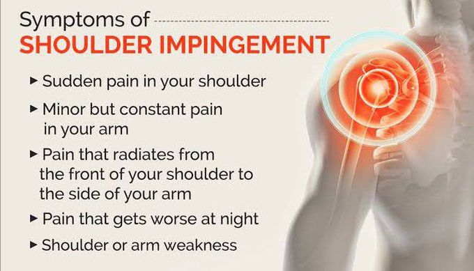 These are the symptoms of Impingement syndrome