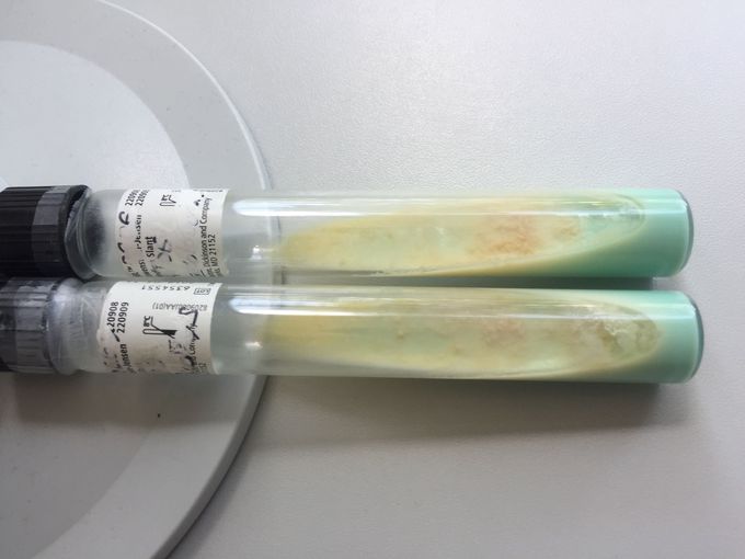 Löwenstein-Jensen Agar with positive M. tuberculosis growth