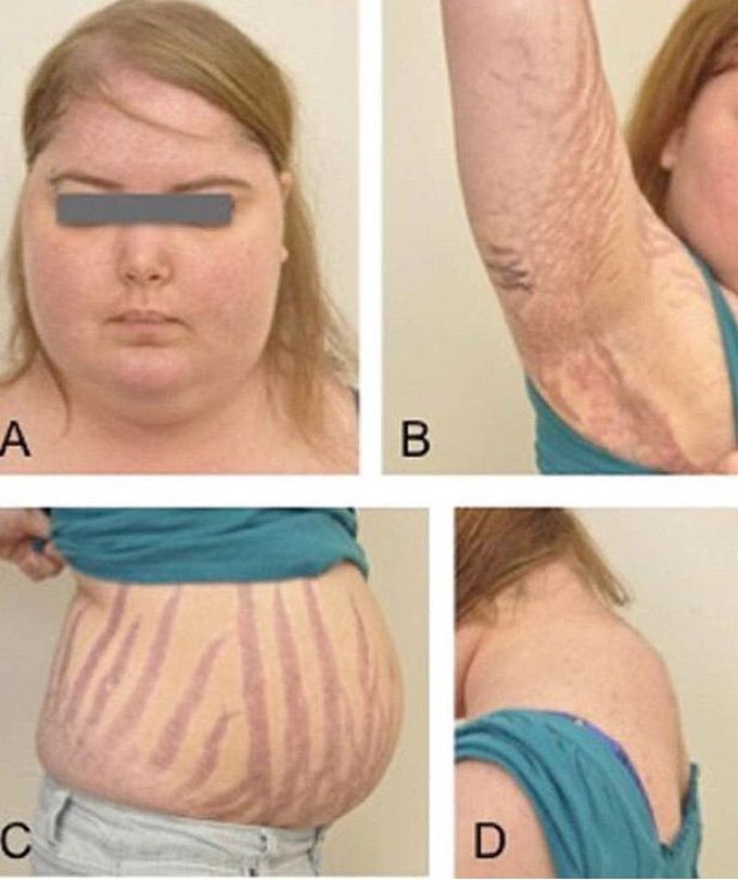 What is your diagnosis??