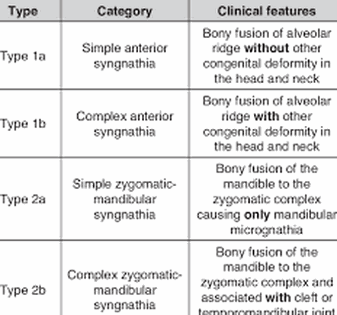 Syngnathia