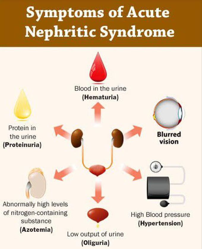 Symptoms of Acute Nephritic Syndrome
