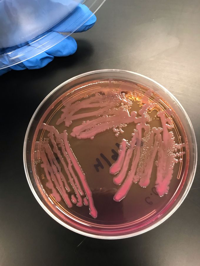 E. coli