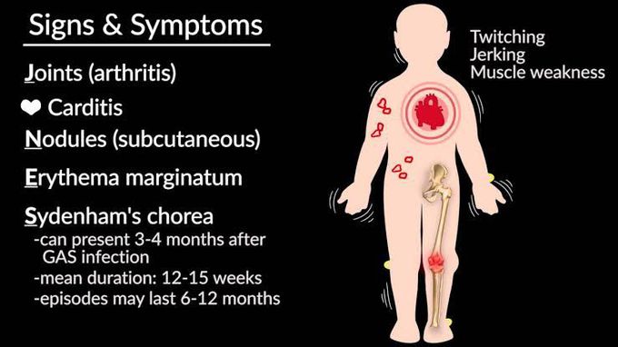 Treatment of rheumatic fever