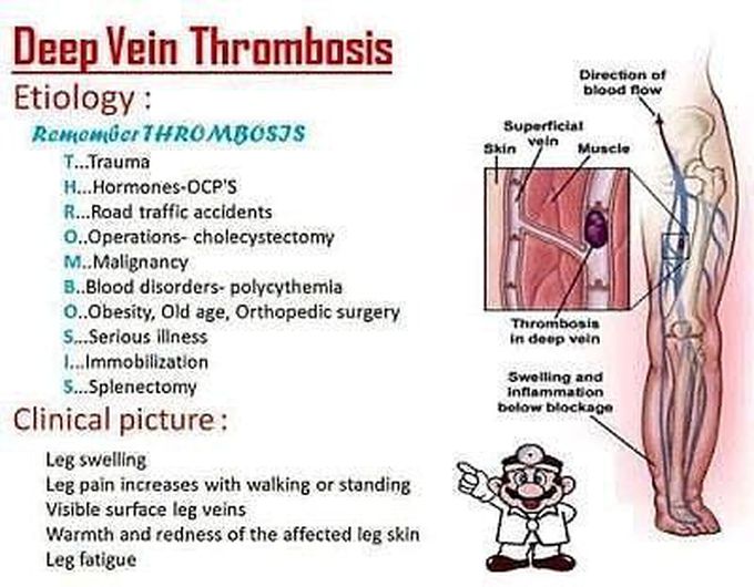 Deep Vein Thrombosis