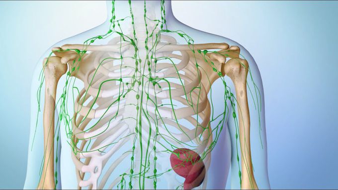 What is Lymphoma?
