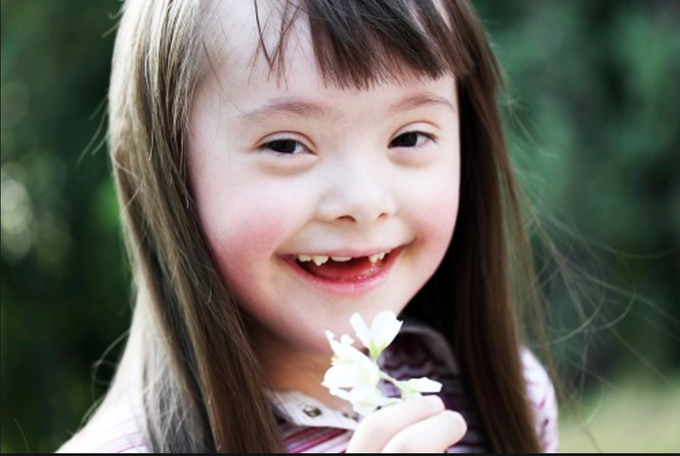 Down syndrome