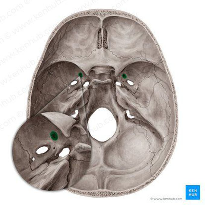 Foramen spinosum