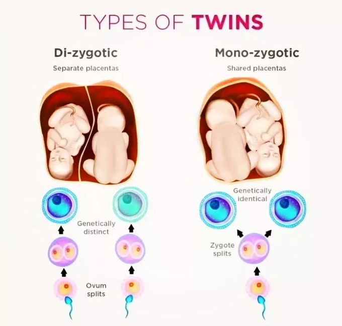 Types of Twins