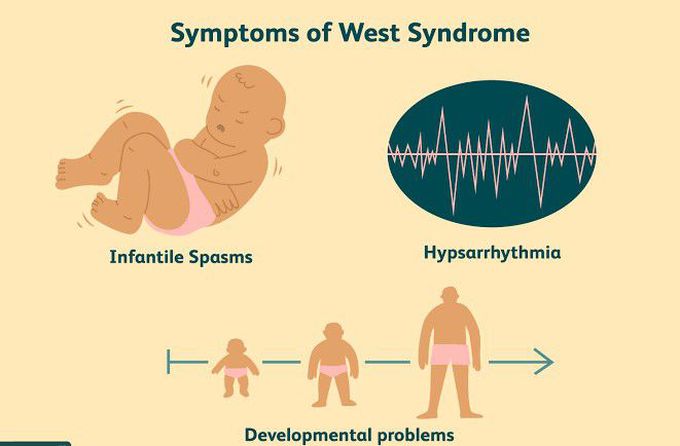 These are the symptoms of West syndrome