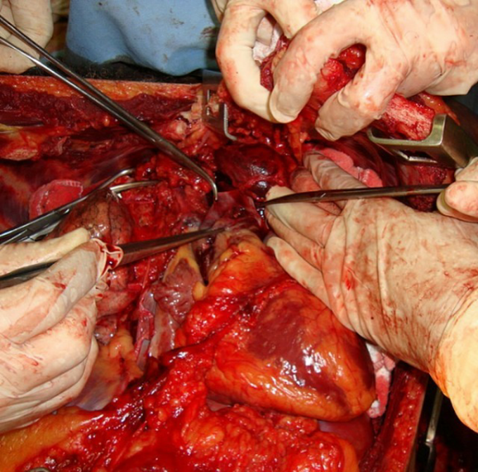 Emergency department