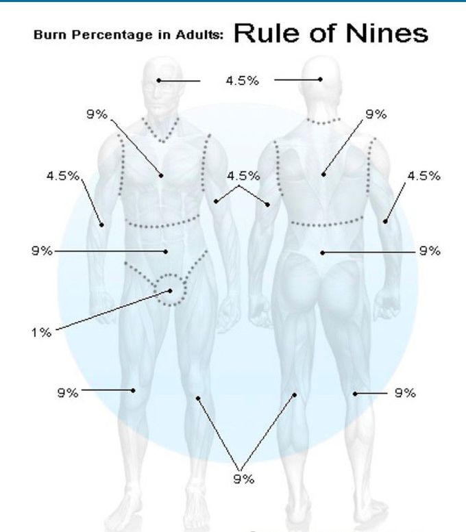 Rule of 9