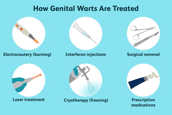 Treatment for HPV genital warts