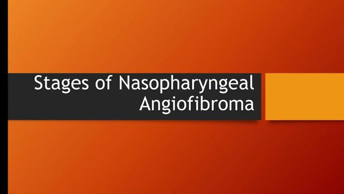 Flashcard- stages of Nasopharyngeal carcinoma