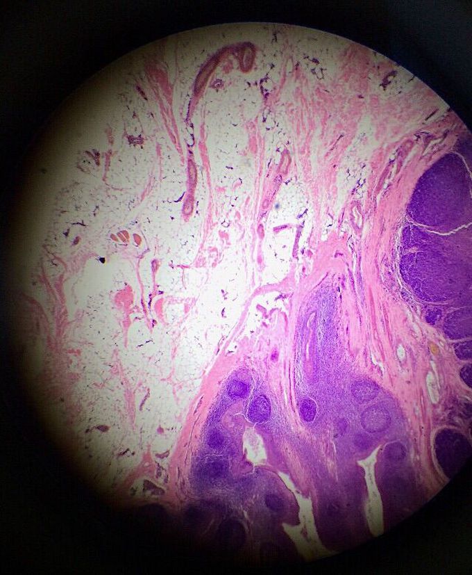 The tonsil of a human with lymph nodes