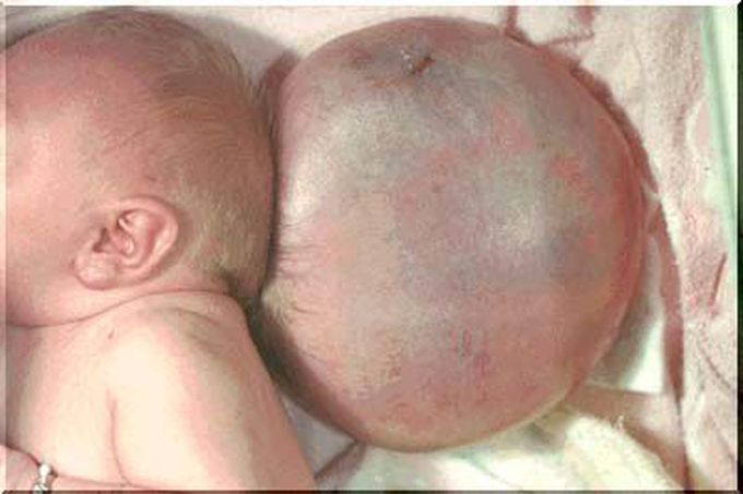 Whats your possible Diagnosis and Management???
