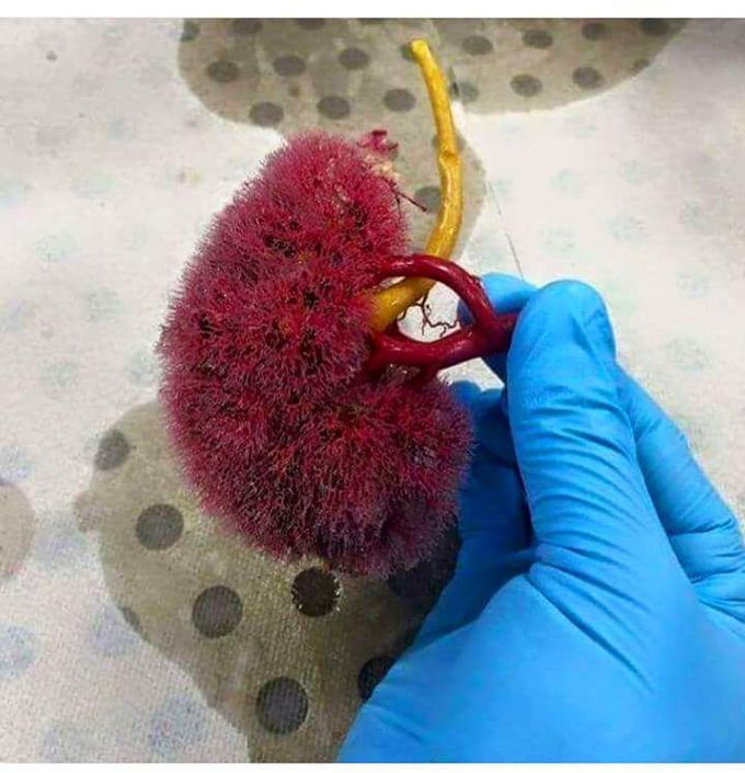 Blood supply of kidney