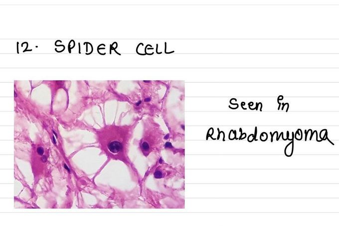 Spider Cell