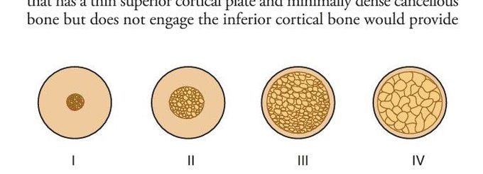 Types of alveolar bone