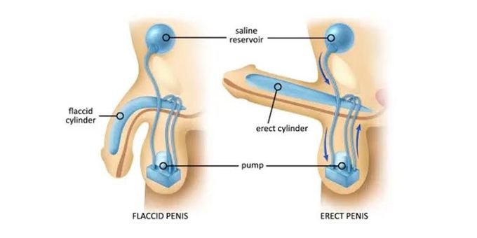 Why does erectile dysfunction occur?
