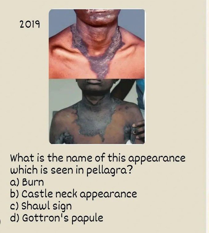 Identify the Appearance